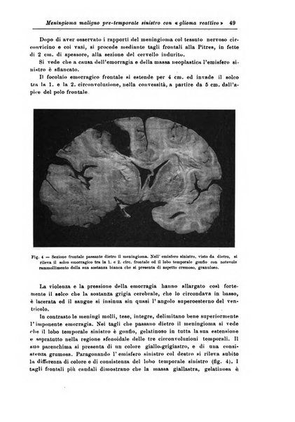 Rivista di patologia nervosa e mentale