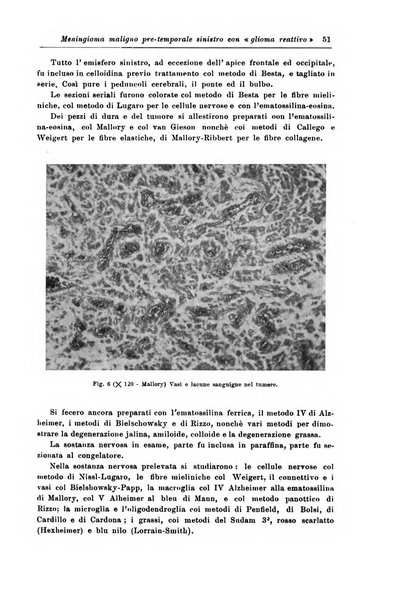 Rivista di patologia nervosa e mentale