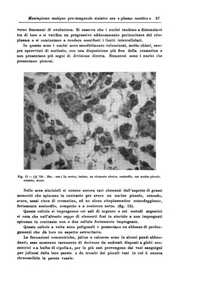 Rivista di patologia nervosa e mentale