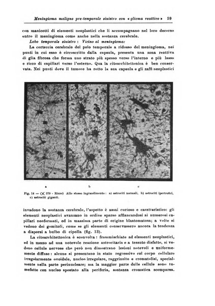 Rivista di patologia nervosa e mentale