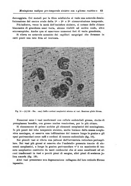 Rivista di patologia nervosa e mentale