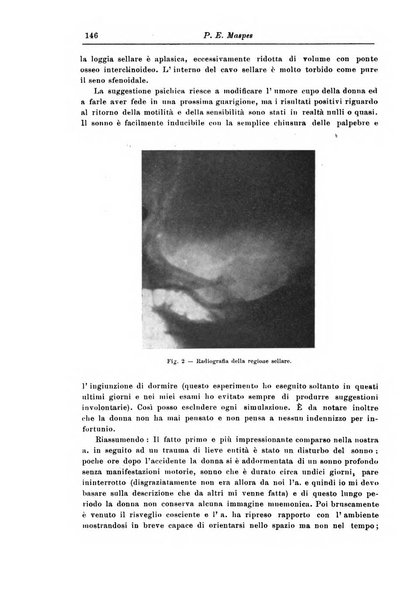 Rivista di patologia nervosa e mentale