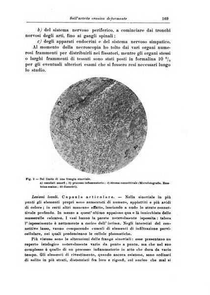 Rivista di patologia nervosa e mentale