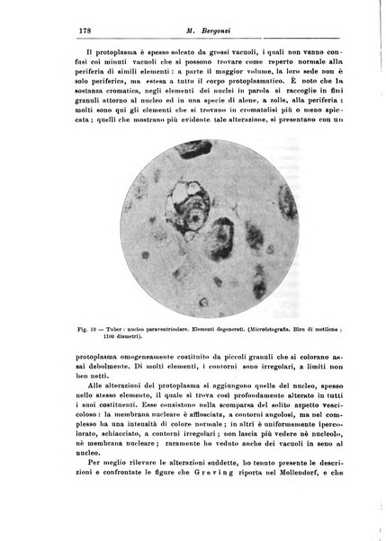 Rivista di patologia nervosa e mentale