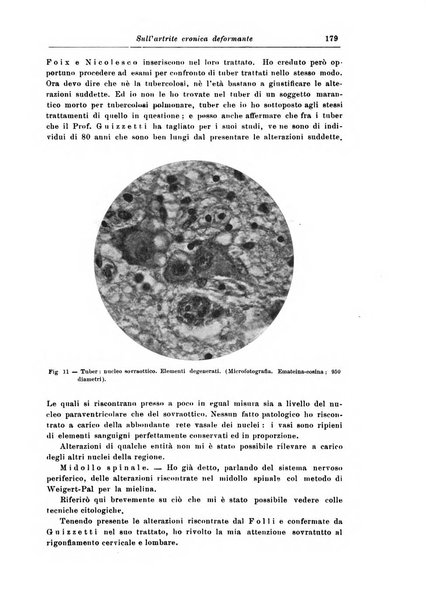 Rivista di patologia nervosa e mentale