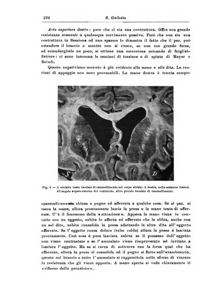 Rivista di patologia nervosa e mentale