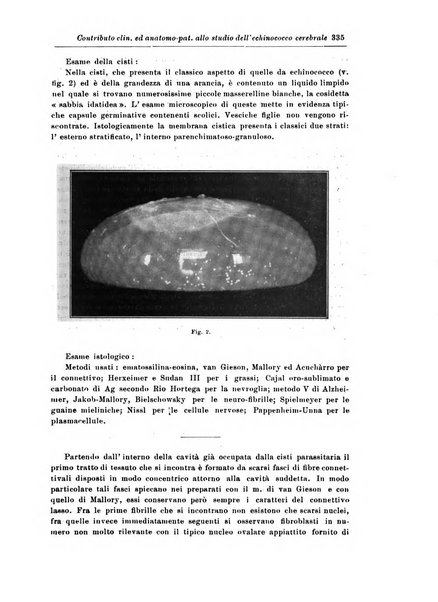 Rivista di patologia nervosa e mentale