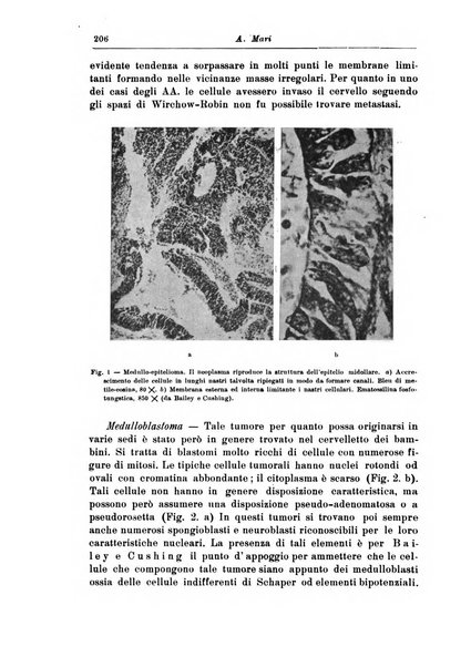 Rivista di patologia nervosa e mentale