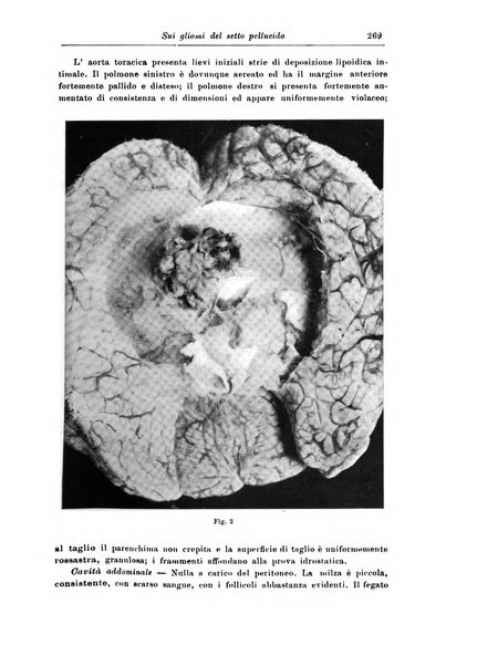 Rivista di patologia nervosa e mentale