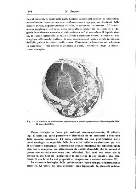 Rivista di patologia nervosa e mentale