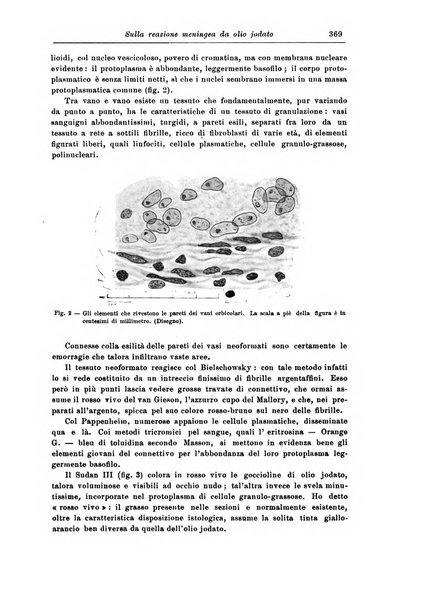 Rivista di patologia nervosa e mentale