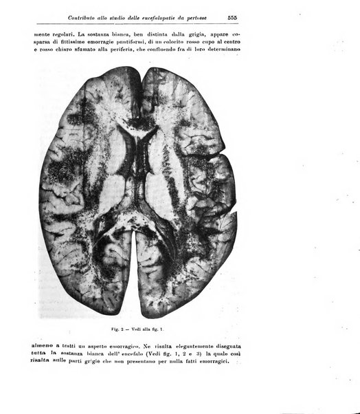 Rivista di patologia nervosa e mentale