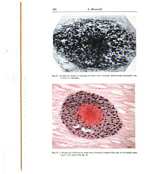 Rivista di patologia nervosa e mentale