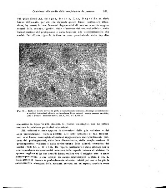 Rivista di patologia nervosa e mentale