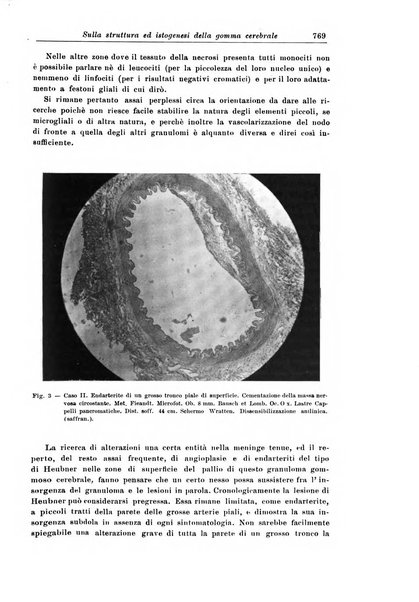 Rivista di patologia nervosa e mentale