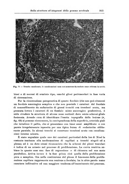 Rivista di patologia nervosa e mentale