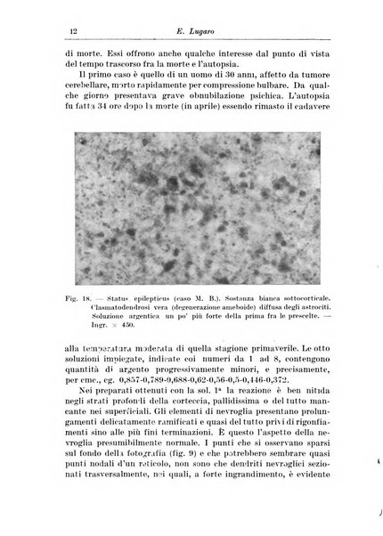 Rivista di patologia nervosa e mentale