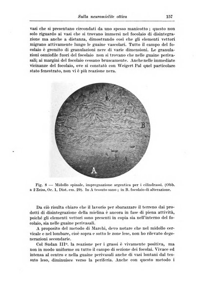 Rivista di patologia nervosa e mentale