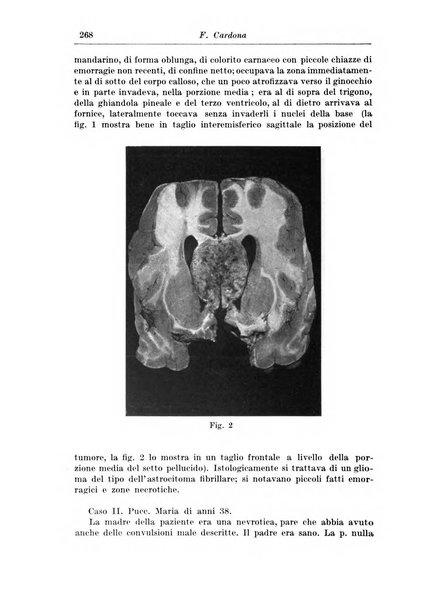 Rivista di patologia nervosa e mentale