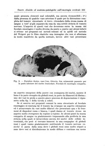 Rivista di patologia nervosa e mentale