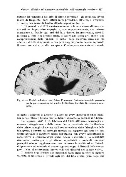 Rivista di patologia nervosa e mentale