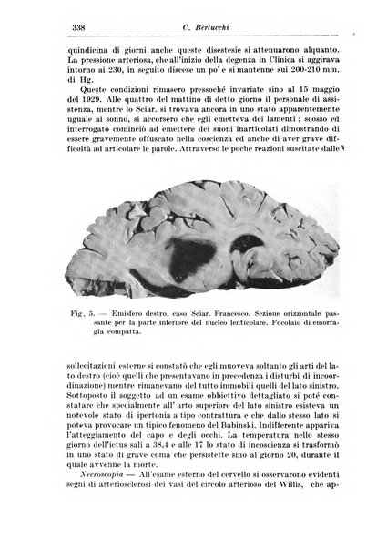 Rivista di patologia nervosa e mentale