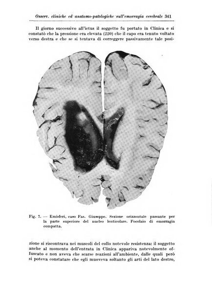 Rivista di patologia nervosa e mentale