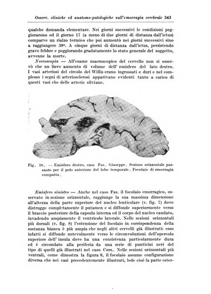 Rivista di patologia nervosa e mentale