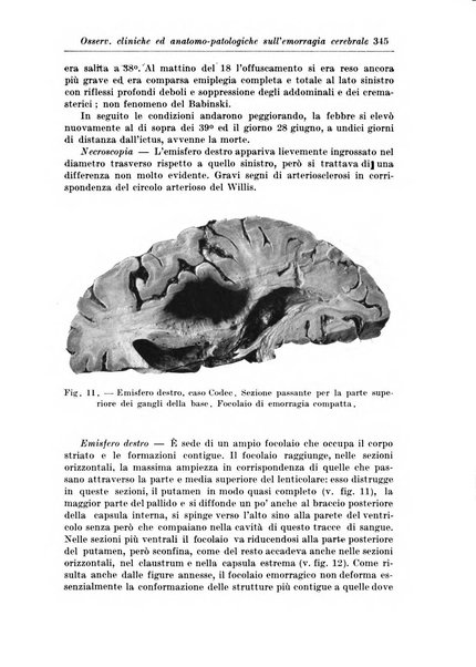 Rivista di patologia nervosa e mentale