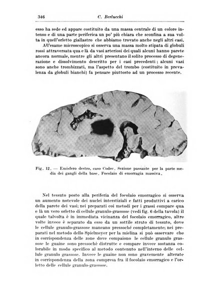 Rivista di patologia nervosa e mentale