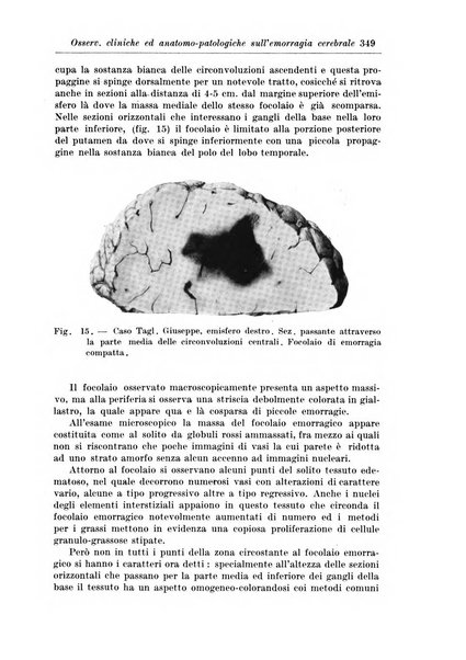 Rivista di patologia nervosa e mentale