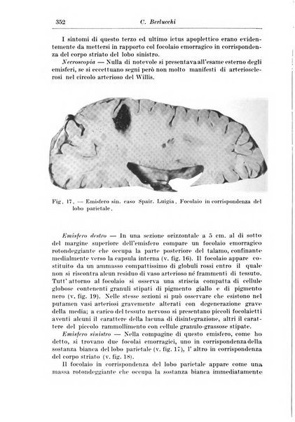 Rivista di patologia nervosa e mentale