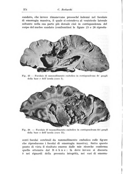 Rivista di patologia nervosa e mentale