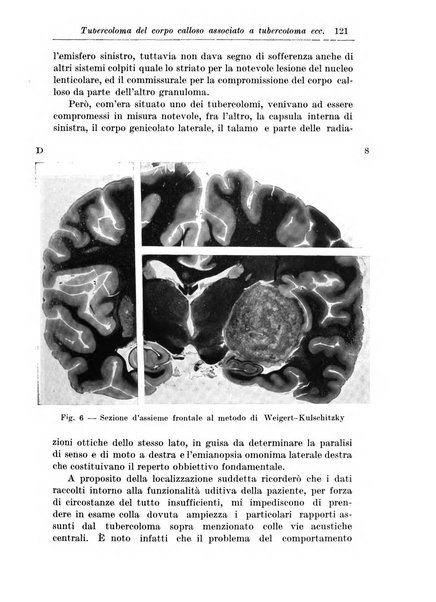 Rivista di patologia nervosa e mentale