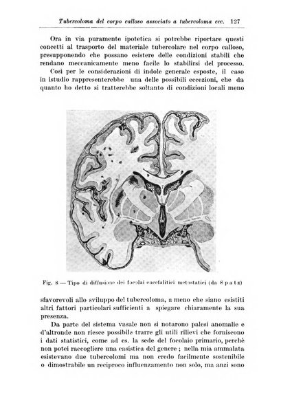 Rivista di patologia nervosa e mentale