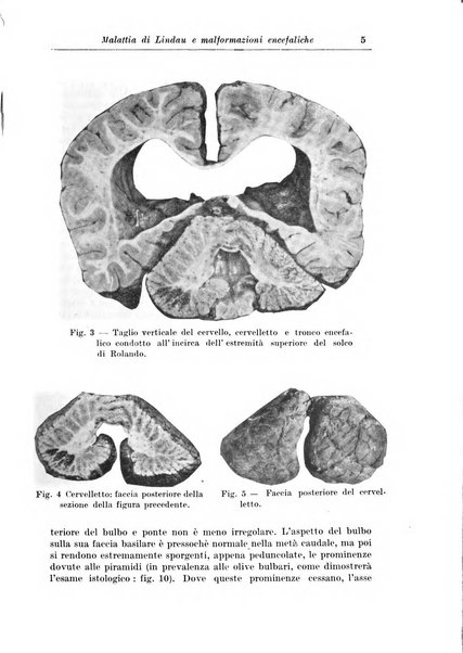 Rivista di patologia nervosa e mentale