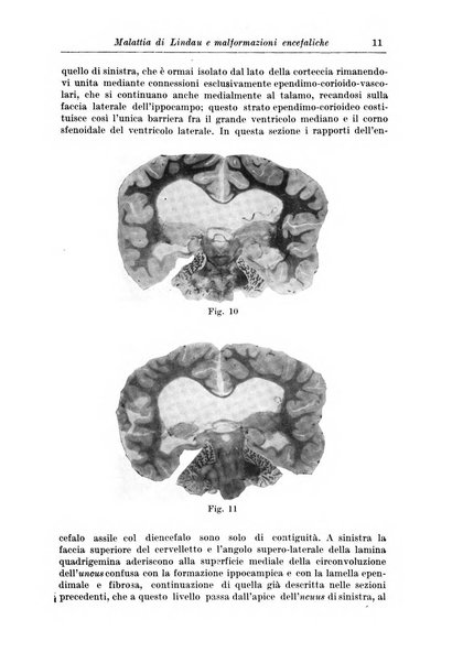 Rivista di patologia nervosa e mentale