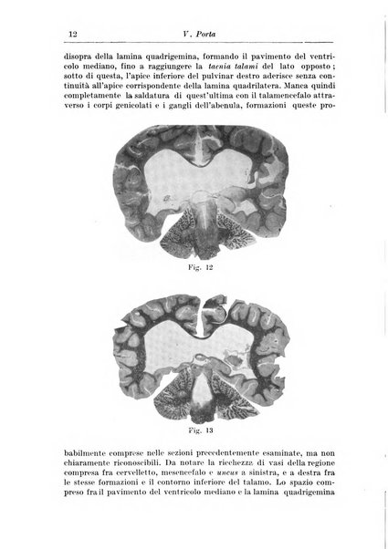 Rivista di patologia nervosa e mentale