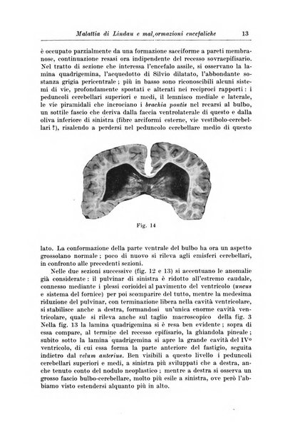 Rivista di patologia nervosa e mentale