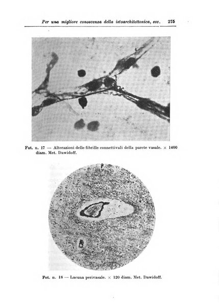 Rivista di patologia nervosa e mentale