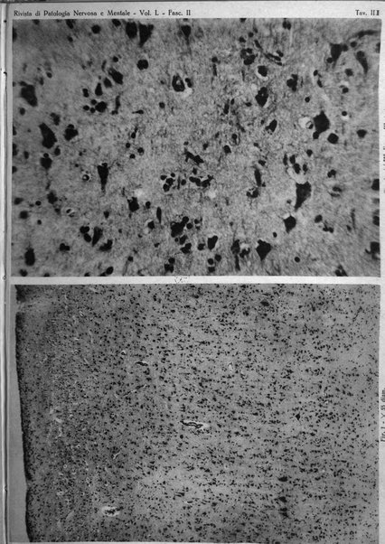 Rivista di patologia nervosa e mentale