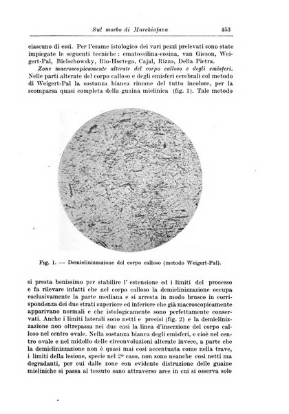 Rivista di patologia nervosa e mentale