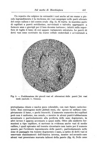 Rivista di patologia nervosa e mentale