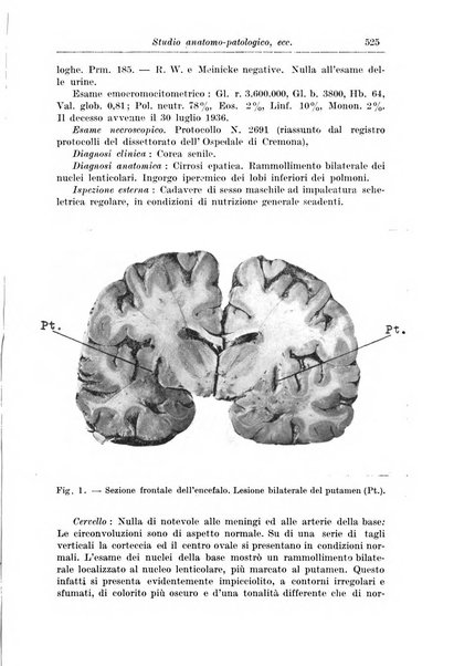 Rivista di patologia nervosa e mentale