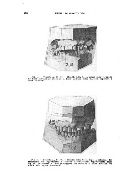 Annali di odontologia periodico mensile