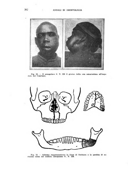 Annali di odontologia periodico mensile