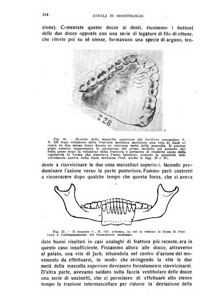 Annali di odontologia periodico mensile