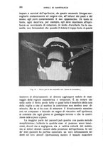 giornale/CFI0343591/1916/unico/00000398