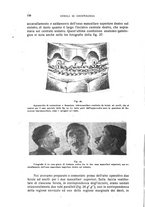giornale/CFI0343591/1918/unico/00000186