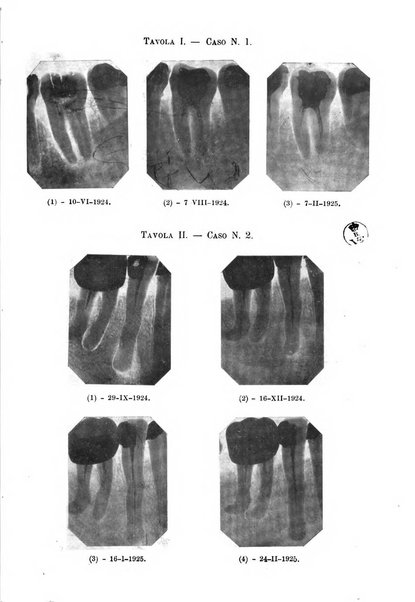 Annali di odontologia periodico mensile